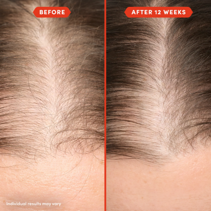 Al-Shaafi Herbal Hair Oil: 50+ Natural Oils for Hair Growth