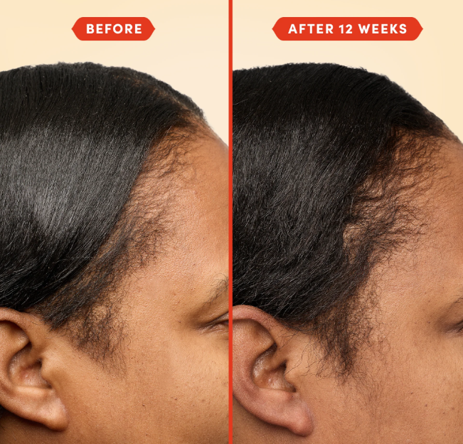 Al-Shaafi Herbal Hair Oil: 50+ Natural Oils for Hair Growth